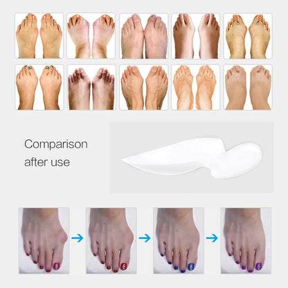 1Pair Orthopedic Hallux Valgus Pro Bunion Corrector Toe Separator Stretchers Bunion Protector Pedicure Tool Silicone Feet Care